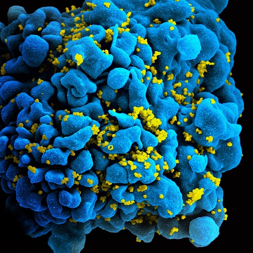 Scanning electromicrograph of an HIV-infected T cell. Image credit NIH, "HIV/AIDS".